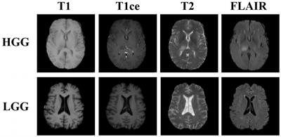 Dual adversarial models with cross-coordination consistency constraint for domain adaption in brain tumor segmentation